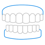 dentures vs implants Immediate, partial and denture repairs at Major Dental Clinics all services